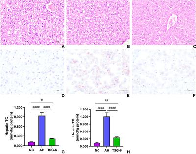 Corrigendum: TSG-6 Inhibits Oxidative Stress and Induces M2 Polarization of Hepatic Macrophages in Mice With Alcoholic Hepatitis via Suppression of STAT3 Activation